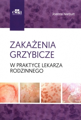 Zakażenia grzybicze w praktyce lekarza rodzinnego - Narbutt Joanna