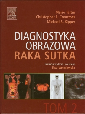 Diagnostyka obrazowa raka sutka Tom 2 - Marie Tartar, Christopher E. Comstock, Michael S. Kipper