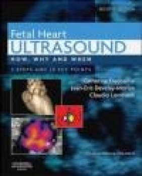 Fetal Heart Ultrasound Claudio Lombardi, Jean-Eric Develay-Morice, Catherine Fredouille