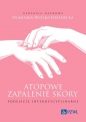 Atopowe zapalenie skóry Podejście interdyscyplinarne - Dominika Wcisło-Dziadecka