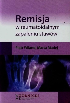 Remisja w reumatoidalnym zapaleniu stawów - Piotr Wiland, Marta Madej