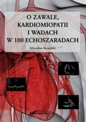 O zawale kardiomiopatii i wadach w 100 echoszaradach - Kowalski Mirosław