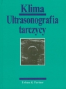 Ultrasonografia tarczycy