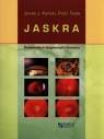Jaskra Kompendium diagnostki i leczenia Kański Jacek J., Tesla Piotr
