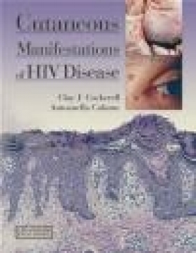 Cutaneous Manifestations of HIV Disease Antoanella Calame, Clay Cockerell