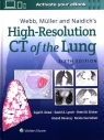Webb, Müller and Naidich's High-Resolution CT of the Lung Sixth edition