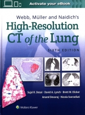 Webb, Müller and Naidich's High-Resolution CT of the Lung Sixth edition - Desai Sujal, Lynch David, Elicker Brett M, Devaraj  Anand, Sverzellati Nicola