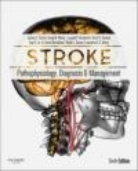 Stroke Lawrence Wong, Ralph Sacco, David Mendelow