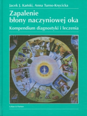 Zapalenie błony naczyniowej oka - Kański Jacek J.Turno-Kręcicka Anna<br />