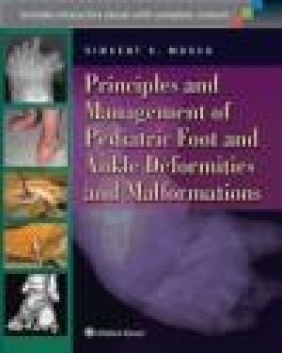 Principles and Management of Pediatric Foot and Ankle Deformities and Malformations