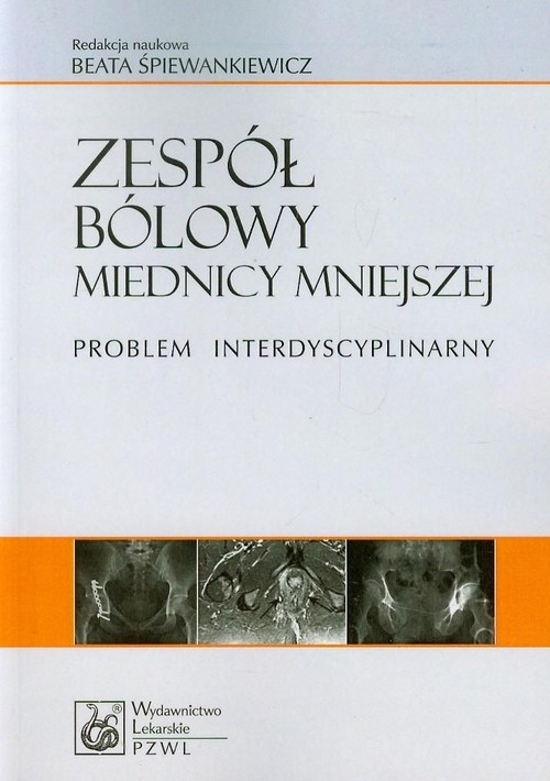 Zespół bólowy miednicy mniejszej