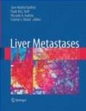 Liver Metastases J-N Vauthey