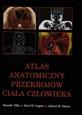Atlas anatomiczny przekrojów ciała człowieka - Harold Ellis, Bari M. Logan, Adrian K. Dixon