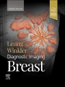 Diagnostic Imaging. Breast Jessica W. T. Leung, Nicole S. Winkler