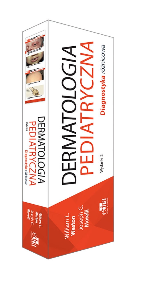 Dermatologia pediatryczna Diagnostyka różnicowa