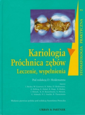 Kariologia Próchnica zębów. Leczenie, wypełnienia