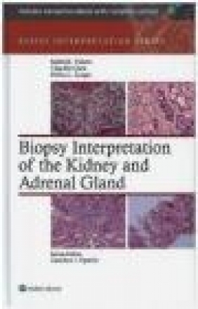 Biopsy Interpretation of the Kidney Debra Zynger, Yinbei Chen, Satish Tickoo