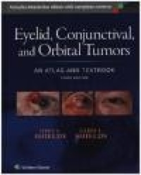 Eyelid, Conjunctival, and Orbital Tumors: An Atlas and Textbook