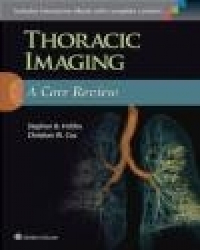 Thoracic Imaging: A Core Review Christian Cox, Stephen Hobbs