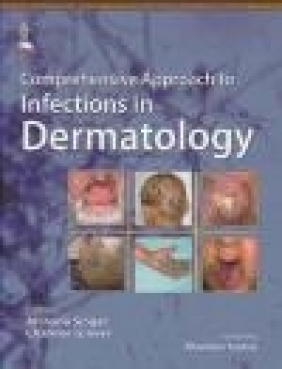 Comprehensive Approach to Infections in Dermatology Archana Singal, Chander Grover