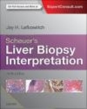 Scheuer's Liver Biopsy Interpretation Jay Lefkowitch