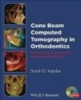 Cone Beam Computed Tomography in Orthodontics Sunil Kapila