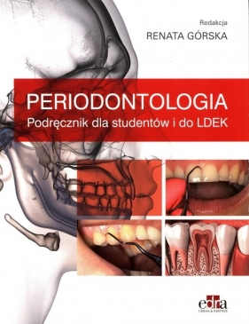 Periodontologia. Podręcznik dla studentów i do Ldek