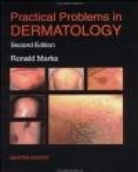 Practical Problems in Dermatology  2e Ronald Marks, R Marks