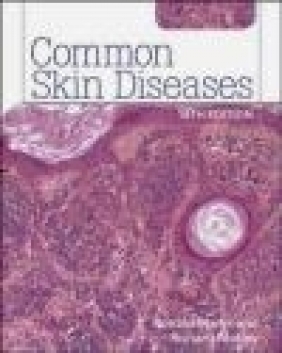 Common Skin Diseases Richard Motley, Ronald Marks