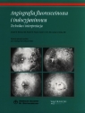 Angiografia fluoresceinowa i indocyjaninowa Technika i interpretacja Berkow Joseph W., Flower Robert W., Orth David H., Kelley James S.
