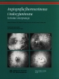 Angiografia fluoresceinowa i indocyjaninowa - Joseph W. Berkow, Robert W. Flower, David H. Orth, James S. Kelley