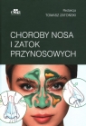  Choroby nosa i zatok przynosowych