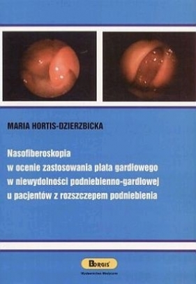 Nasofiberoskopia w ocenie zastosowania płata gardłowego w niewydolności podniebieniowo-gardłowej u pacjentów z rozszczepieniem podniebienia - Hortis-Dzierzbicka Maria