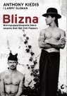 Blizna Anthony Kiedis, Larry Sloman