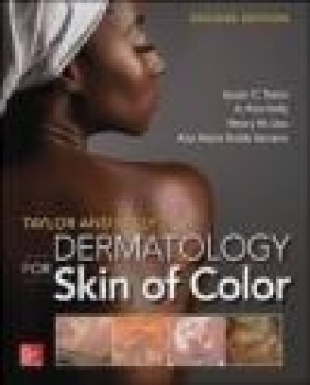 Taylor and Kelly's Dermatology for Skin of Color Ana Maria Anido Serrano, Henry Lim, Paul Kelly