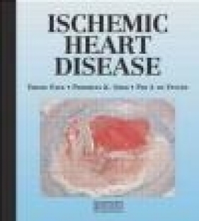 Ischemic Heart Disease de Feyter