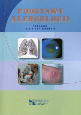 Podstawy alergologii (Uszkodzona okładka)