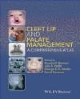 Cleft Lip and Palate Management David Genecov, George Sandor