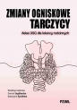 Zmiany ogniskowe tarczycy. Atlas USG dla lekarzy rodzinnych - Dorota Szydlarska, Katarzyna Życińska