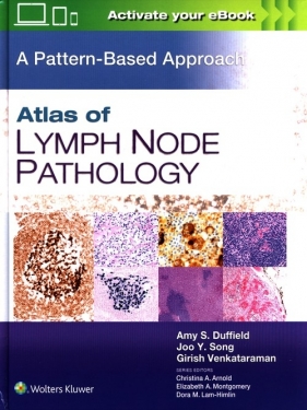Atlas of Lymph Node Pathology - Duffield Amy S., Song  Joo Y., Venkataraman Girish