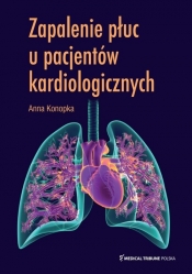 Zapalenie płuc u pacjentów kardiologicznych - Konopka Anna 