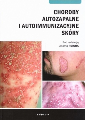 Choroby autozapalne i autoimmunizacyjne skóry - Adam Reich