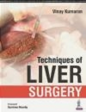 Techniques of Liver Surgery Vinay Kumaran