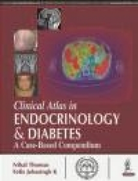 Clinical Atlas in Endocrinology