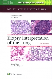 Biopsy Interpretation of the Lung Second edition - Suster Saul, Suster David
