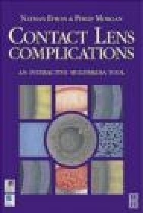 Contact Lens Complications Philip Morgan, Nathan Efron, B Efron