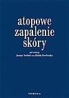 Atopowe zapalenie skóry