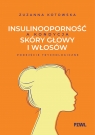  Insulinooporność a kondycja skóry głowy i włosów. Podejście