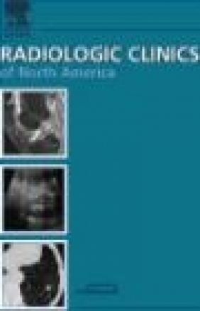 Pediatric Chest Imaging An Issue of Radiologic Clinics Donald P. Frush,  Frush