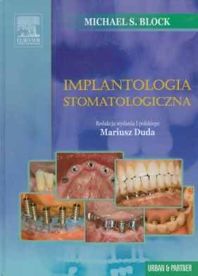 Implantologia stomatologiczna - Block Michael S.<br />